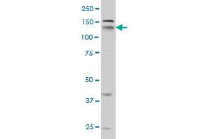 NRP1 monoclonal antibody (M05), clone 1B3 Western Blot analysis of NRP1 expression in HeLa . (Neuropilin 1 antibody  (AA 22-131))