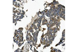 IHC analysis of ME2 using anti-ME2 antibody (ABIN7600967). (NAD-ME antibody  (AA 26-584))