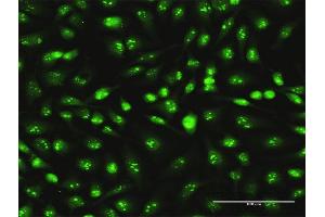 Immunofluorescence of monoclonal antibody to SKP1 on HeLa cell. (SKP1 antibody  (AA 53-160))