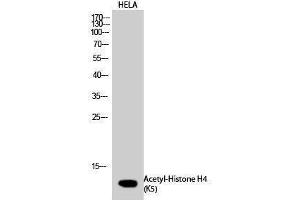 Western Blotting (WB) image for anti-Histone H4 (acLys5) antibody (ABIN6285507) (Histone H4 antibody  (acLys5))