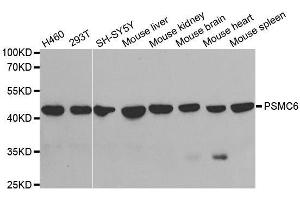 Western blot analysis of extracts of various cell lines, using PSMC6 antibody. (PSMC6 antibody  (AA 20-150))
