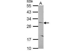 WB Image Sample (30 ug of whole cell lysate) A: SK-N-SH 12% SDS PAGE antibody diluted at 1:500 (CNOT8 antibody)