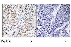 Image no. 1 for anti-Myc Proto-Oncogene protein (MYC) (Thr358) antibody (ABIN197157) (c-MYC antibody  (Thr358))