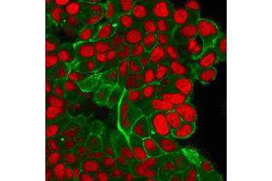 Flow Cytometric Analysis of trypsinized PFA-fixed MCF-7 cells. (ErbB2/Her2 antibody  (AA 311-462))