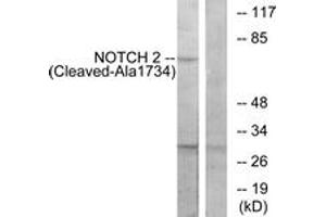 Western blot analysis of extracts from Jurkat cells, treated with etoposide 25uM 24h, using NOTCH2 (Cleaved-Ala1734) Antibody. (NOTCH2 antibody  (Cleaved-Ala1734))