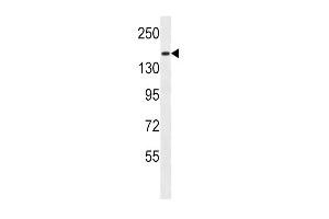 PCDH9 Antibody (C-term) (ABIN657109 and ABIN2837896) western blot analysis in MDA-M cell line lysates (35 μg/lane). (Protocadherin 9 antibody  (C-Term))