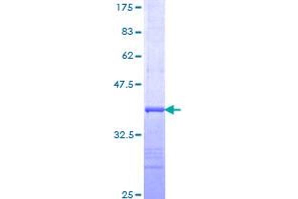 Hemoglobin Subunit beta Protein (AA 38-147) (GST tag)