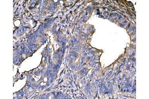 IHC analysis of SNAP23 using anti-SNAP23 antibody (ABIN7603236). (SNAP23 antibody  (N-Term))