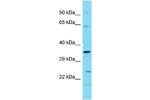Host: Rabbit  Target Name: Tbc1d7  Sample Tissue: Mouse Stomach lysates  Antibody Dilution: 1.