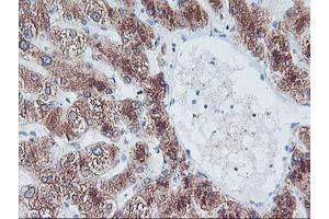 Immunohistochemical staining of paraffin-embedded Human liver tissue using anti-FBXO21 mouse monoclonal antibody. (FBXO21 antibody)