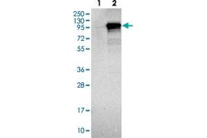 Western blot analysis of Lane 1: Negative control (vector only transfected HEK293T lysate). (IQCE antibody)
