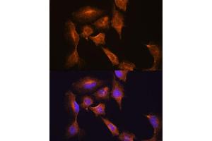 Immunofluorescence analysis of C6 cells using HOOK3 antibody (ABIN7267781) at dilution of 1:100. (HOOK3 antibody  (AA 489-718))