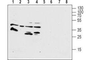Western blot analysis of human HL-60 promyelocytic leukemia (lanes 1 and 4), human THP-1 acute monocytic leukemia (lanes 2 and 6), human T-84 colorectal carcinoma (lanes 3 and 7) and human U-87 MG glioblastoma (lanes 4 and 8) cell lysates: - 1-4.