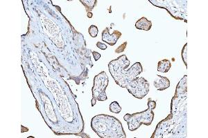 IHC analysis of EIF3E using anti-EIF3E antibody (ABIN7600190).