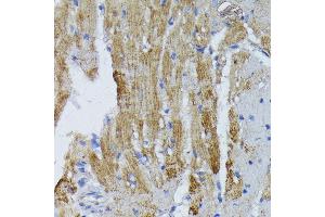 Immunohistochemistry of paraffin-embedded mouse heart using ACADL antibody (ABIN1678519, ABIN3015429, ABIN3015430 and ABIN6216381) at dilution of 1:100 (40x lens). (ACADL antibody  (AA 31-210))