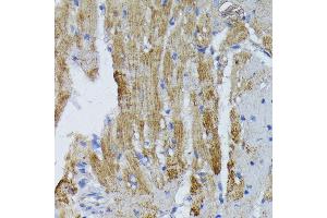 Immunohistochemistry of paraffin-embedded mouse heart using ACADL antibody (ABIN1678519, ABIN3015429, ABIN3015430 and ABIN6216381) at dilution of 1:100 (40x lens). (ACADL antibody  (AA 31-210))