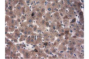 Immunohistochemical staining of paraffin-embedded Human thyroid tissue using anti-L1CAM mouse monoclonal antibody. (L1CAM antibody)