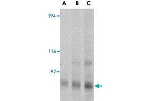 Western blot analysis of GRIK4 in rat brain tissue lysate with GRIK4 polyclonal antibody  at (A) 0. (GRIK4 antibody  (N-Term))