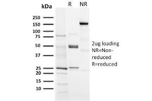 SDS-PAGE Analysis Purified Aurora B Rabbit Recombinant Monoclonal (AURKB/3121R). (Recombinant Aurora Kinase B antibody  (AA 89-251))
