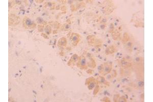 DAB staining on IHC-P; Samples: Human Liver Tissue (SIGLEC9 antibody  (AA 23-142))