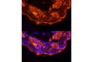 Immunofluorescence analysis of mouse skin using LORICRIN Rabbit pAb (ABIN7268295) at dilution of 1:200 (40x lens). (LOR antibody)