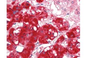 Human Adrenal: Formalin-Fixed, Paraffin-Embedded (FFPE). (IFRD1 antibody  (AA 38-87))