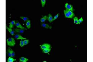 Immunofluorescent analysis of HepG2 cells using ABIN7174052 at dilution of 1:100 and Alexa Fluor 488-congugated AffiniPure Goat Anti-Rabbit IgG(H+L) (TYRO3 antibody  (AA 728-873))