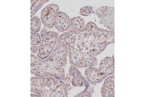 Immunohistochemistry (Paraffin-embedded Sections) (IHC (p)) image for anti-Discoidin Domain Receptor tyrosine Kinase 1 (DDR1) (AA 299-330) antibody (ABIN391458)
