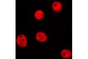 ABIN6275684 staining Hela by IF/ICC. (ZBTB40 antibody  (Internal Region))