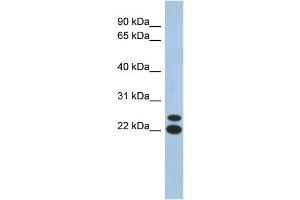 WB Suggested Anti-C19orf54 Antibody Titration: 0. (C19orf54 antibody  (N-Term))