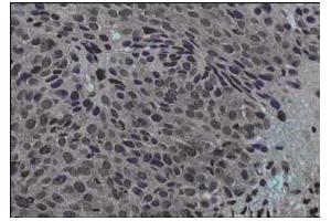 Immunohistochemistry (IHC) image for anti-Jagged 1 (JAG1) (N-Term) antibody (ABIN129524)