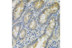 Immunohistochemistry of paraffin-embedded rat intestine using KRT20 Antibody. (KRT20 antibody  (AA 245-424))