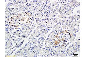 Formalin-fixed and paraffin embedded: rat pancreas tissue labeled with Anti-PP-1B Polyclonal Antibody (ABIN725465), Unconjugated at 1:300 followed by conjugation to the secondary antibody and DAB staining (PPP1CB antibody  (AA 155-250))