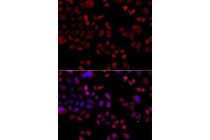 Immunofluorescence analysis of A549 cells using SLC22A11 antibody. (SLC22A11 antibody  (AA 40-150))