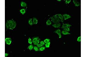 Immunofluorescent analysis of PC-3 cells using ABIN7147921 at dilution of 1:100 and Alexa Fluor 488-congugated AffiniPure Goat Anti-Rabbit IgG(H+L)