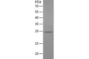 NOS2 Protein (AA 1-196) (His tag)