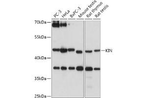 Western blot analysis of extracts of various cell lines, using KIN antibody (ABIN7268118) at 1:1000 dilution. (KIN antibody  (AA 180-270))