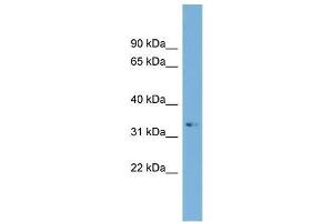 Human Jurkat; WB Suggested Anti-ARL13B Antibody Titration: 0. (ARL13B antibody  (C-Term))