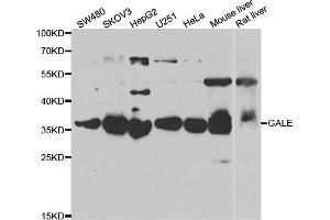 Western blot analysis of extracts of various cell lines, using GALE antibody (ABIN5973962) at 1/1000 dilution.