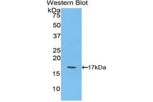 Western Blotting (WB) image for anti-Ly1 Antibody Reactive (LYAR) (AA 271-386) antibody (ABIN1859730) (LYAR antibody  (AA 271-386))