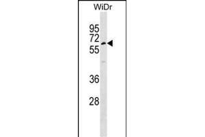 TULP1 Antibody (Center) (ABIN1537977 and ABIN2848730) western blot analysis in WiDr cell line lysates (35 μg/lane). (TULP1 antibody  (AA 184-211))