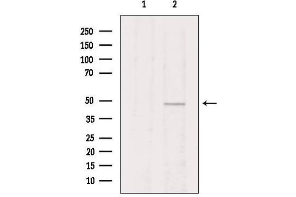 VIPR2 antibody  (Internal Region)