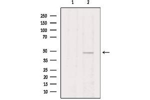 Western blot analysis of extracts from Hela, using VIPR2 Antibody. (VIPR2 antibody  (Internal Region))