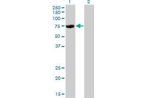 Western Blot analysis of CBFA2T2 expression in transfected 293T cell line by CBFA2T2 monoclonal antibody (M15), clone 2C10. (CBFA2T2 antibody  (AA 201-304))