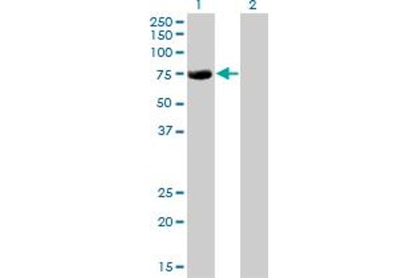 CBFA2T2 anticorps  (AA 201-304)