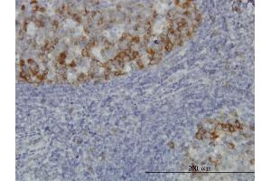 Immunoperoxidase of monoclonal antibody to BUB1B on formalin-fixed paraffin-embedded human tonsil. (BUB1B antibody  (AA 1-130))