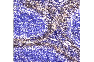 IHC analysis of S100A10 using anti-S100A10 antibody . (S100A10 antibody  (AA 4-94))