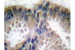 Image no. 1 for anti-Collagen, Type XVIII, alpha 1 (COL18A1) (Chain alpha 1) antibody (ABIN265401) (COL18A1 antibody  (Chain alpha 1))