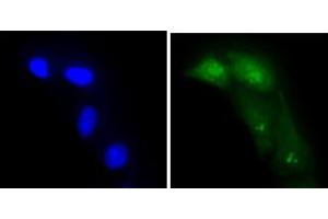 ICC/IF analysis of ADK in A549 cells line, stained with DAPI (Blue) for nucleus staining and monoclonal anti-human ADK antibody (1:100) with goat anti-mouse IgG-Alexa fluor 488 conjugate (Green). (ADK antibody  (AA 22-362))