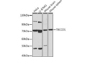Western blot analysis of extracts of various cell lines, using TBCCD1 Rabbit pAb (ABIN7270751) at 1:1000 dilution. (TBCCD1 antibody)